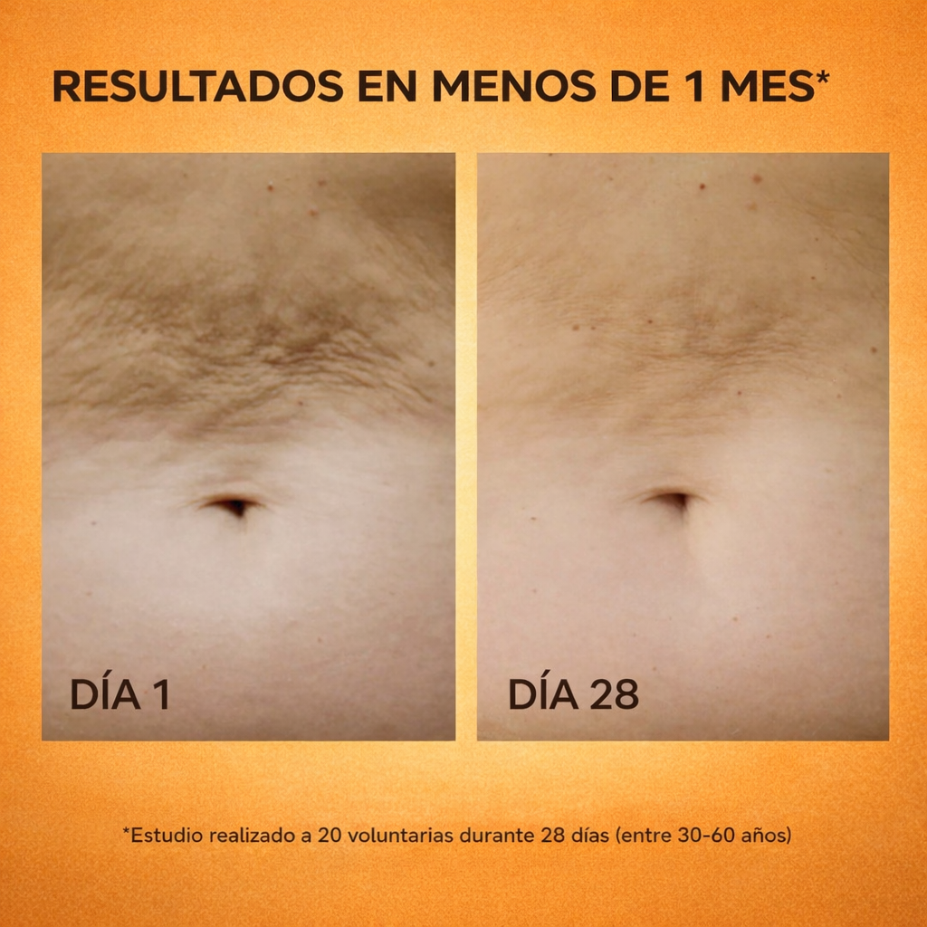 Face&Body SCULPTOR™ + Gel Conductor 100 mL | Elimina la celulitis con tecnología clínica desde casa